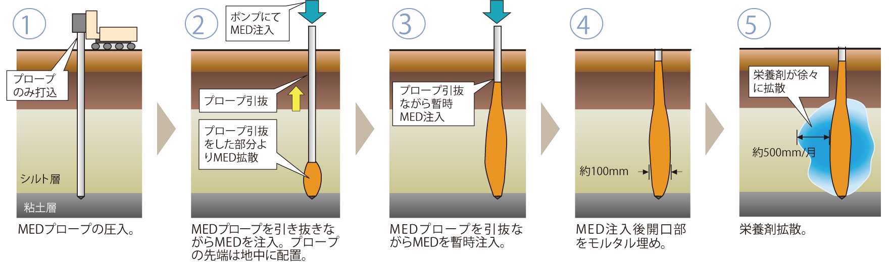 MED注入概念